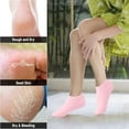 thumbnail image 2 of Monebena 5 Pairs Silicone Socks for Women, Silicone moisturizing Socks for Dry Cracked Feet Woman, Silicone Foot Socks for Soft Foot Care, Skin Color, 2 of 14