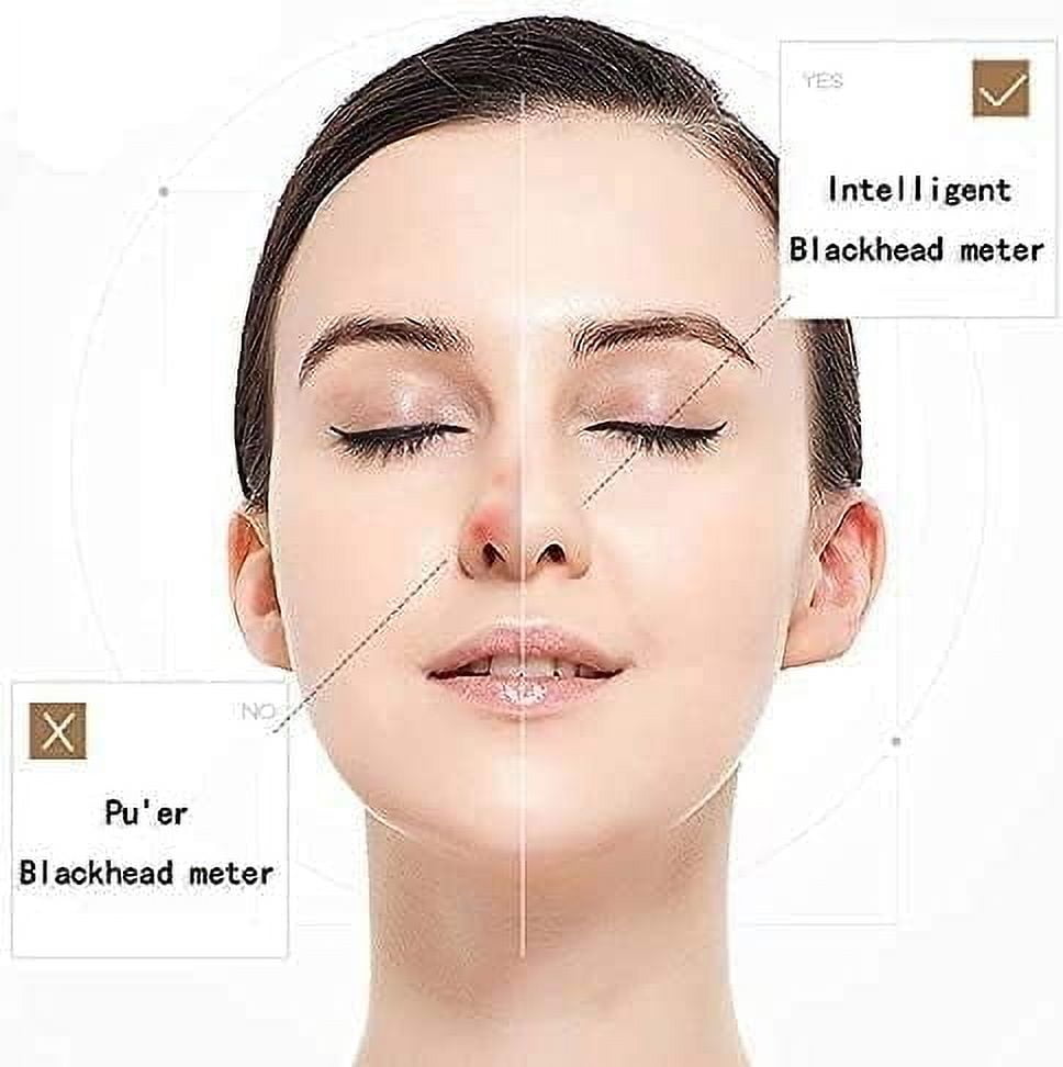 CNV Blackhead Remover Vacuum Pore Cleaner - Electric Blackhead Suction Devices USB Rechargeable, with 4 Adjustable Suction Intensities and 4 Replacement Probes