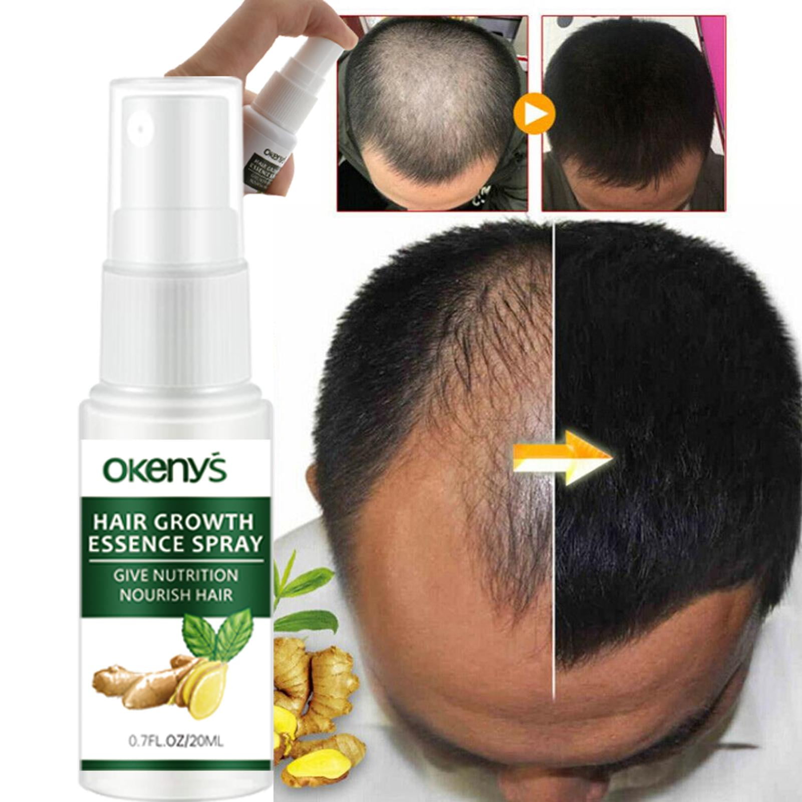 Atralife Nursing Essence Hair Nourishing Spray Hair Growth Thicken Essence  