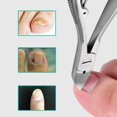 thumbnail image 2 of 6X Professional Feet Toe Nail Clippers Trimmer Cutters Paronychia Nippers Podiatry Stainless Foot Care Tools, 2 of 8