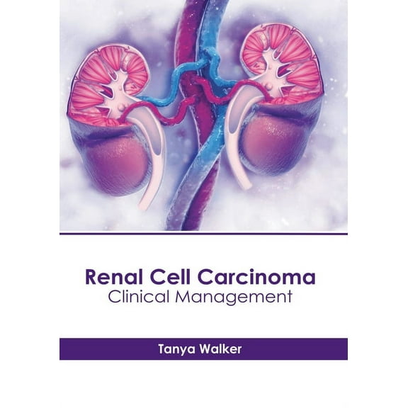 Renal Cell Carcinoma: Clinical Management, (Hardcover)