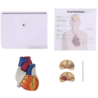 Milue Life Size Disassembled Anatomical Human Heart Anatomy Model for School Science Resources Study Display Teaching Tool