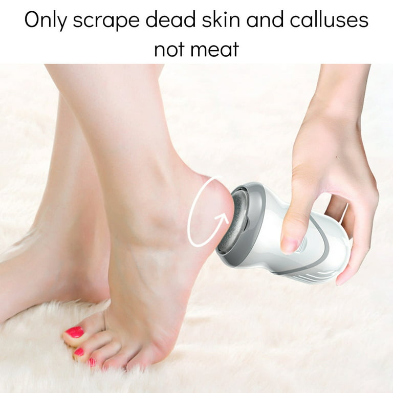 Foot File Remove Skin Foot Care Tool Callus Remover Foot ScrubberFor  Removing Dead Skin, Washing And Repairing Foot Soles, Removing Calluses And  Dead Skin On The Feet, Scraping The Heels, And Grinding