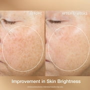 StriVectin Super-C Retinol بواسطة StriVectin ، 1 أونصة سيروم