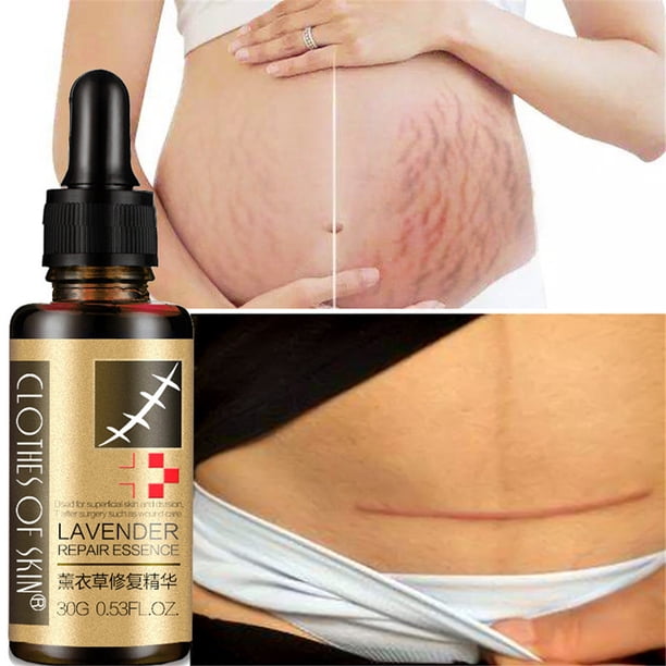 Aceites esenciales yaluronic Piel AntiAge Acné 30ml Clearance Essential Oils