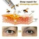 thumbnail image 2 of Bee Venom Wrinkle Removal Cream,Bee Venom Anti-Wrinkle Firming Moisturizing,Lifting & Recovery for All Skin Types 2025, 2 of 5