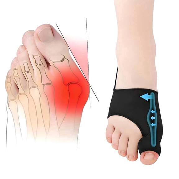 2PCS Bunion Corrector for Women & Men Big Toe Straightener - Bunions Correction Tool for - Bunion Splint with Soft Pads - Hallux Valgus Pain Relief, Breathable Fabric for Day & Night Wear