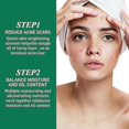 thumbnail image 4 of Jaysuing Tea Tree Oil Acne Essence Smallpox Diluting Facial Sensitive Reddish Hydrating Repair Acne Essence |, 4 of 4