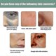 thumbnail image 5 of Eelhoe Collagen Anti-aging Essence Dilutes Fine Lines And Wrinkles Repairing Anti-wrinkle Anti-aging Essence-M, 5 of 5