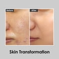 thumbnail image 5 of [Tonificador] MEDI-PEEL Aqua Essence Peptide 9, 250 ml, antienvejecimiento, 5 of 5