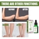 thumbnail image 2 of Aceite Corporal 10 ml cafeína cuerpo desintoxicación suero vientre cintura calefacción masaje aceite pérdida de peso Ehuebsd Cuidado Belleza, 2 of 7