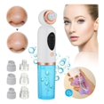 thumbnail image 2 of Extractor eliminador de puntos negros para limpieza facial de espinillas 2281, 2 of 6