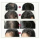 thumbnail image 4 of Biotin & Collagen Hair Growth Serum, Hydrolyzed Collagen & Biotin Oil for Hair Growth, Hair Nutrient Solution Make Hair Smooth, Soft and Light, 4 of 5