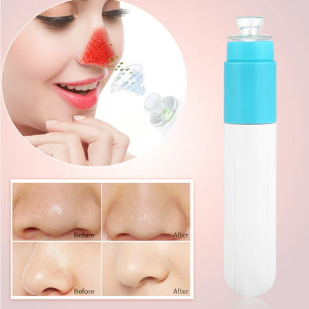 4 Colors Electric Pore Cleaner,Facial Skin Cleansing Acne Removing Blackhead Absorbing Device,Pore Cleaner, Acne Removing