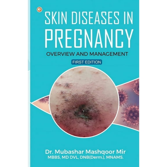 Skin Diseases in Pregnancy: Overview and Management, (Paperback)