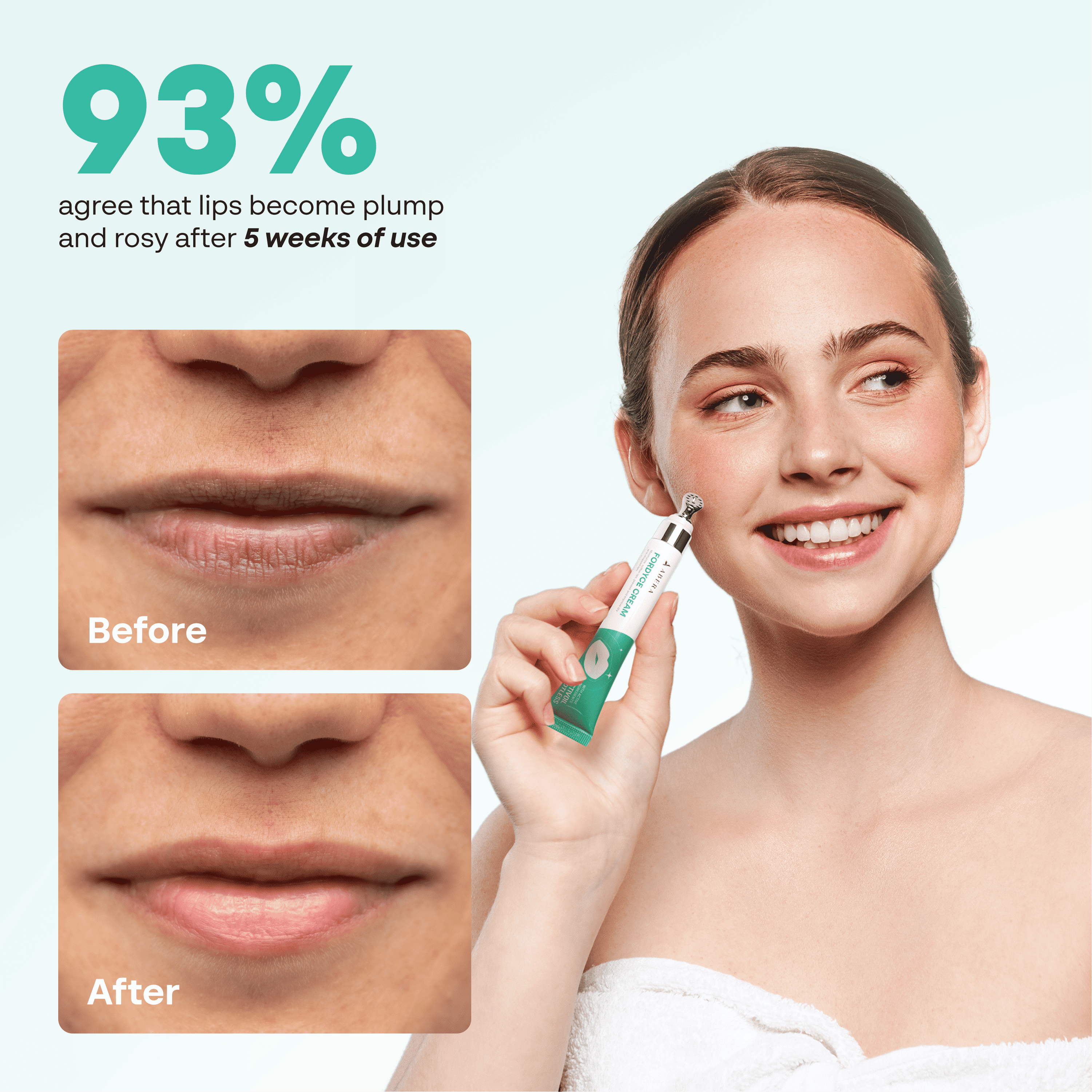 ABERA Fordyce Spot Lip Cream with HPR Retinoid, Moisturizing Repair For Dry Chapped Lips, 0.7 fl oz - Combo 2