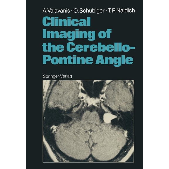 Clinical Imaging of the Cerebello-Pontine Angle, (Paperback)