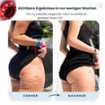 thumbnail image 5 of Woveruco For Cellulite,Lymphatic Drainage Massager & Anti-Cellulite Tool,Vacuvia Sculpt Glow Cellulite Remover for Legs - Helps Reduce Cellulite In The Abdomen, Arms, and Legs, 5 of 8