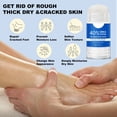 thumbnail image 4 of Joint Foot Cuticle Softens And Gently Moisturizes Foot Skin Moisturizing Foot, 4 of 6