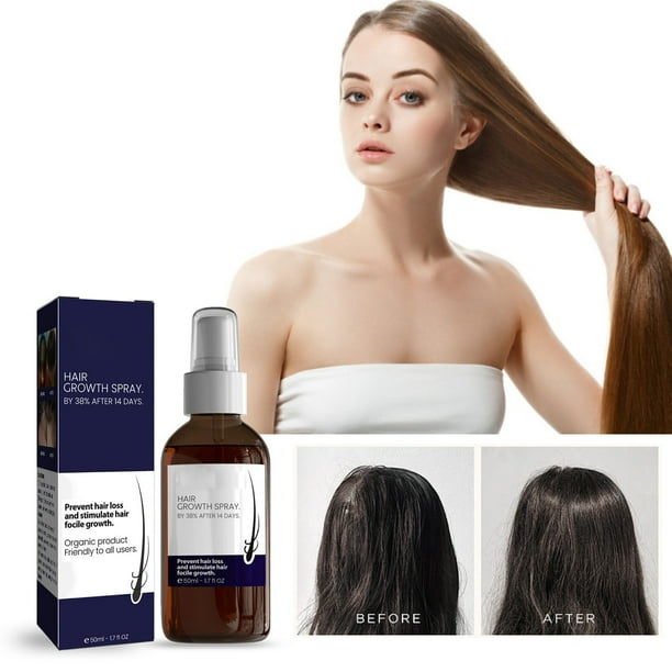 Fiudx Spray En Crecimiento Del Cabello, Las Raíces, Nourishmax Spray, Promue En Crecimiento de La Barba, Fórmula Thickgrow, Previene La Caída, Solución Restorepro, para Cabello y Barba, Apto para Hom