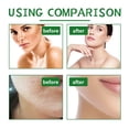 thumbnail image 4 of Fiudx Ofertas flash del día solo en línea Exfoliate facial natural, exfoliate aloe para puntos negros, manchas oscuras y acné, exfoliate rostro, cuerpo y pies para eliminar la suciedad, 4 of 7