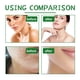thumbnail image 3 of Exfoliante corporal, exfoliante corporal, exfoliante facial natural, exfoliante de aloe para puntos negros, manchas oscuras y acné, exfoliante facial, corporal y de pies., 3 of 5