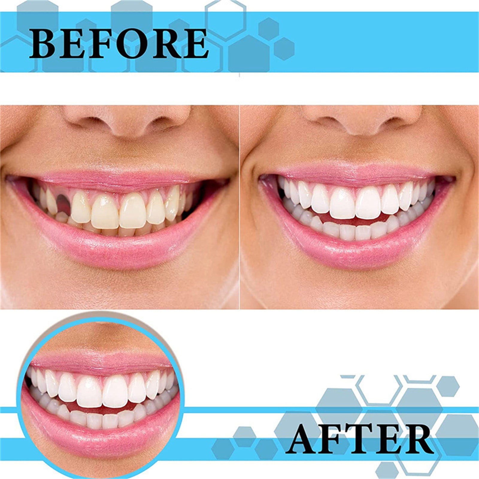 Teeth ning 22% Brush Kits Denture Bath Teeth Full Set Teeth Thermal Fitting Beads Bulk Wild Boar Teeth Teeth Filling for Brush Cup Travel Braces Straight Teeth Teeth Straightener for