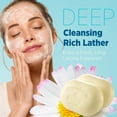 thumbnail image 3 of Roycederm Sulfur Soap for Acne Support: Sulfur Face Wash Bar for Sensitive Skin and Blemish-Prone Areas - Sulfur Body Cleanser with 10% Volcanic Sulfur, Tea Tree Oil - 2 Bars, 3 of 6