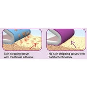 Mölnlycke Mepilex Soft Silicone Absorbent Foam Dressing, 4 x 4