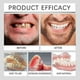 thumbnail image 5 of Premium Custom Dentures,Smileasego Dentures False Teeth Set, 5 of 5