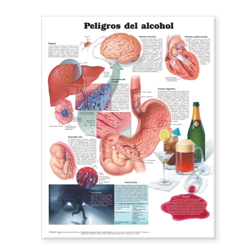 Dangers of Alcohol Anatomical Chart in Spanish (Peligros del alcohol