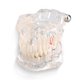 thumbnail image 1 of Educational study on dental diseases: demonstration of adult typodonts, new model of teeth, 1 of 4