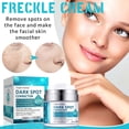 thumbnail image 2 of Press Whitening Spots Remover Cream Lightens Spots, Chloasma Freckles Brightens Skin Tone Spots Remover Cream 50ml, 2 of 4