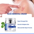 thumbnail image 2 of Estrías, cesárea, quemaduras, eliminación de cicatrices, crema quirúrgica para cicatrices, 50ML, 2 of 5
