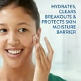 thumbnail image 3 of Hydratant matifant antiacné, 3 of 6
