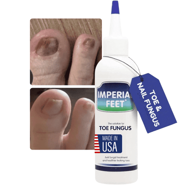 Toenail Fungus - Severe Fungal Nail Treatment - Damaged Yellow Nail Care - Nail Care for Discolored & Brittle Toenails - XL - Nail Mysocis Improved Formula