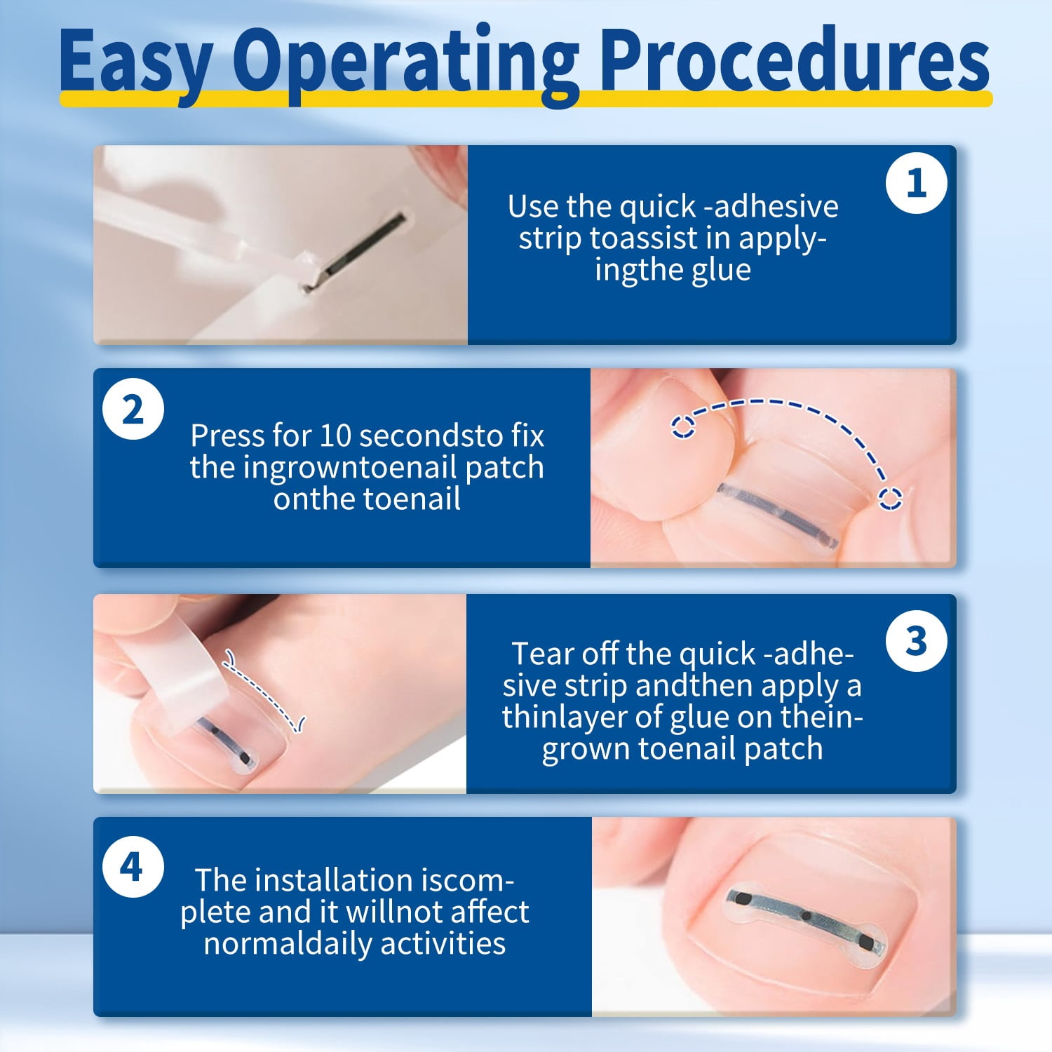 Ingrown Toenail Removal Kit  Professional Tools for Ingrown Toenail Treatment with Nail Clippers, Pusher, File & Corrector  Cure & Prevent Painful Ingrown Nails for Toes & Fingers