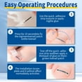 thumbnail image 4 of Titanium Ingrown Toenail Corrector Kit - Professional Pedicure Tools, 4 of 8