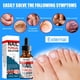 thumbnail image 3 of Nail fungo treatment - soluciones antifúngicas y tratamientos de hongos de uñas bajo las uñas - reparación de dedos y uñas CAIXIN Solución reparadora para uñas, 3 of 6