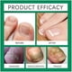 thumbnail image 4 of 1-3X Nail shield ANTI-FUNGAL STICK Nailshield Anti Fungal Stick, Monsalife Nail Shield Anti Fungal Stick, 4 of 5