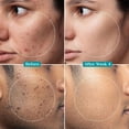 thumbnail image 4 of Pilgrim 2% Alpha Arbutin Brightening Serum,30ml, 4 of 5