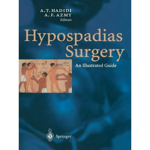 Hypospadias Surgery: An Illustrated Guide, (Paperback)