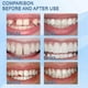 thumbnail image 4 of Cortador de encías dental inalámbrico ZHAOCHENG de gutapercha para dientes internos + 4 puntas, 4 of 5