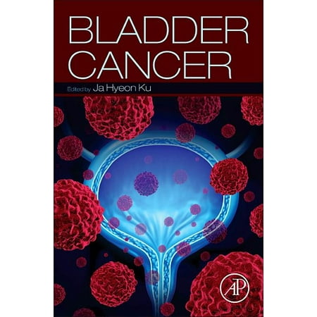 UPC: 9780128099391 | Bladder Cancer (Paperback)