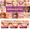 thumbnail image 5 of Pasta de dientes, Pasta de dientes blanqueadora, Pasta de dientes blanqueadora probiótica SP-4 Pasta de dientes blanqueadora Pasta de dientes blanqueadora Pasta de dientes SP-4 Blanqueamiento dental U, 5 of 5