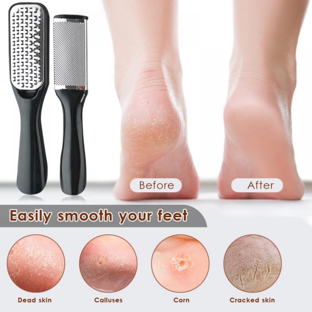 Smooth Pedicure Wand – My Store