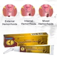 thumbnail image 1 of Crema Para Hemorroides Crema para aliviar el dolor de fisura Anal de 20g, ungüento eficaz para hemorroides para hombres y mujeres Sywqhk Cuidado Belleza, 1 of 7