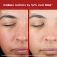 thumbnail image 4 of Protector solar EltaMD UV Skin Recovery SPF 50 100 ml, paquete de 2, 4 of 9