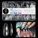 thumbnail image 1 of Uñas postizas, uñas postizas, regalos para mujeres, 140/120 piezas, uñas con forma de diamante, uñas irregulares, uñas postizas, puntas de uñas, 1 of 4
