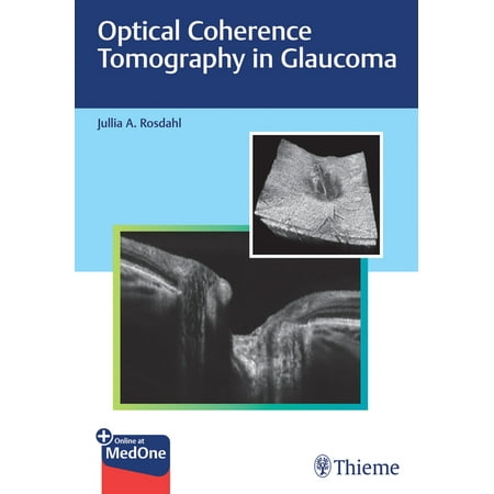 UPC: 9781684202478 | Optical Coherence Tomography in Glaucoma (Hardcover)
